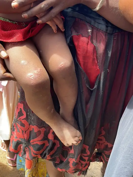 NamRano, au service de la santé dans les zones reculées